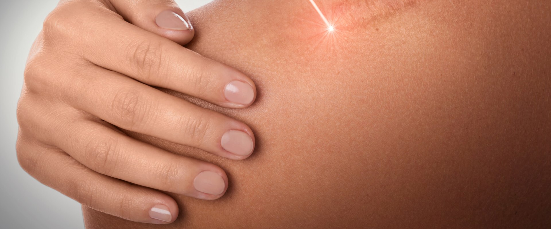 Scar Tissue Pain Relief That Works: Expert-Backed Tips