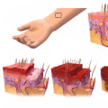 The Importance of Understanding the Different Degrees of Burns